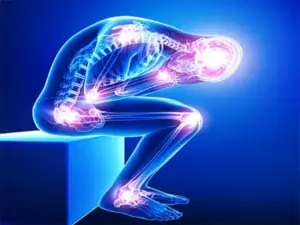 Fibromyalgia syndrome(FMS)