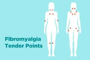 Fibromyalgia Syndrome (FMS)